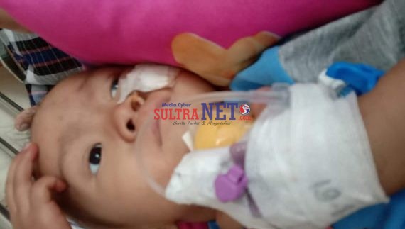 Muhammad Anan, Balita penderita Tumor Mata